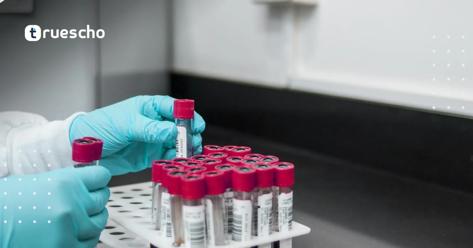 تحاليل الخصوبة للرجال