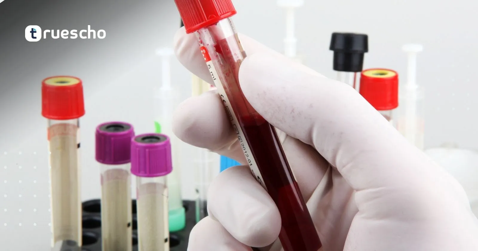 كيفية الحصول على نتيجة GAMCA برقم الجواز