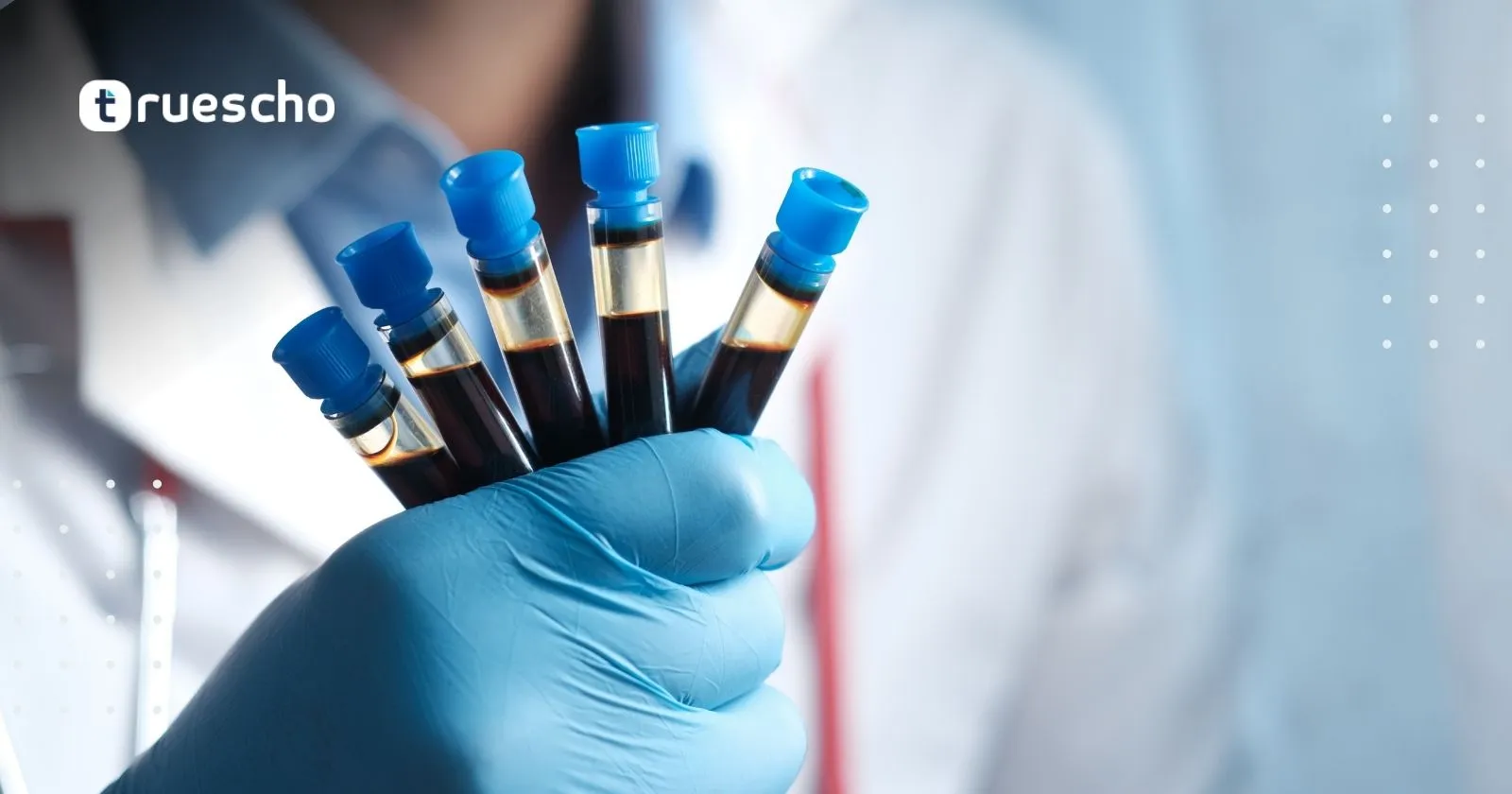 رموز تحاليل الكبد