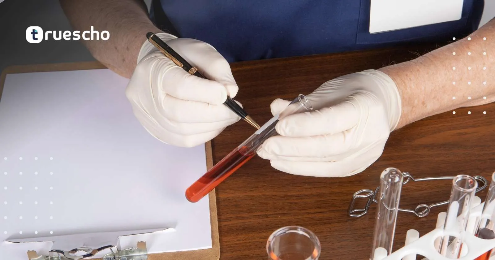 تحاليل سيولة الدم