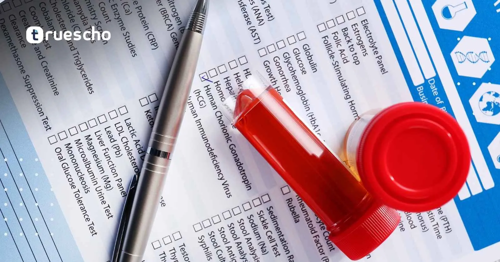 تحاليل الغدد اللمفاوية