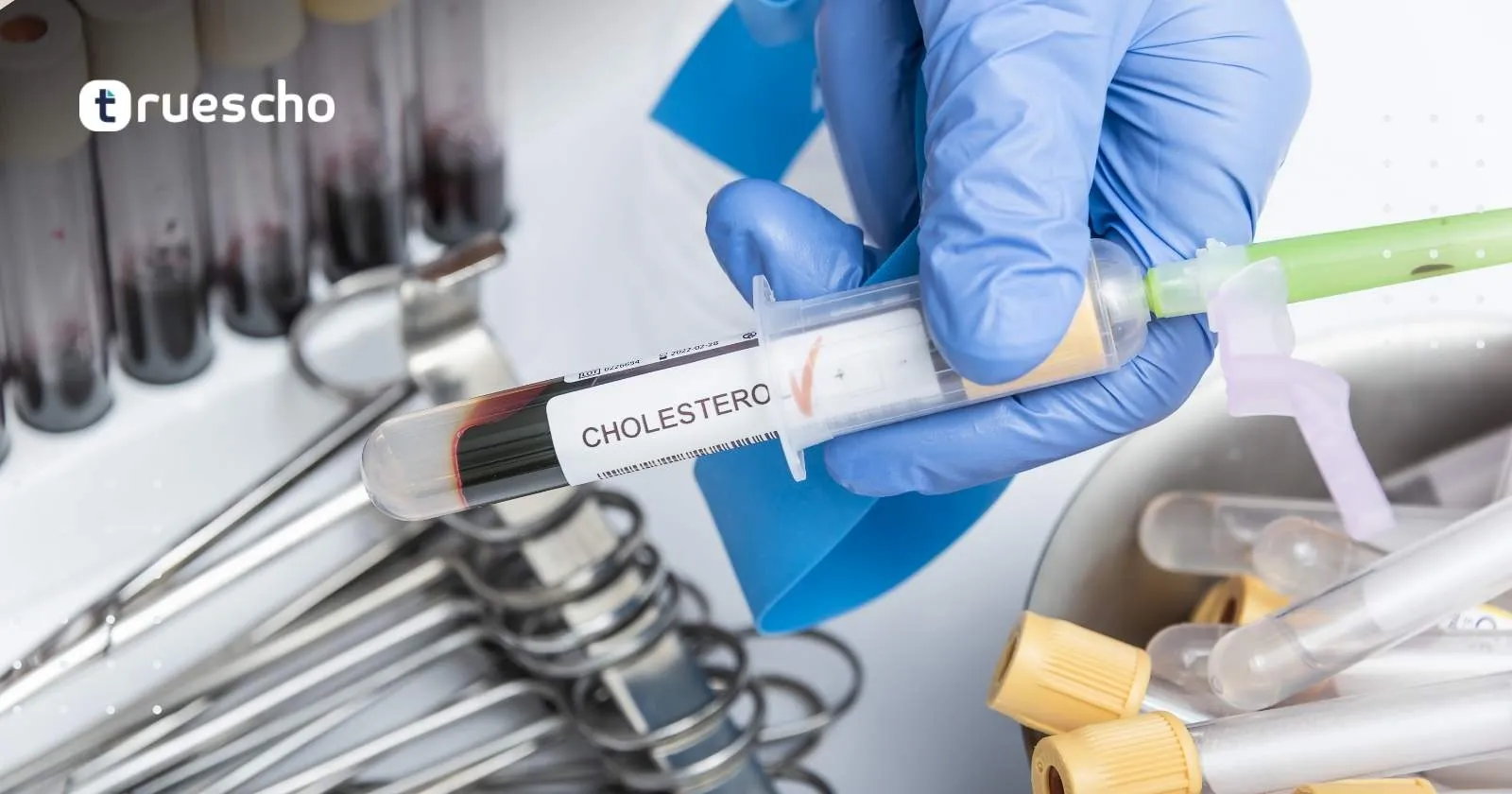 تحاليل منزلية في جدة